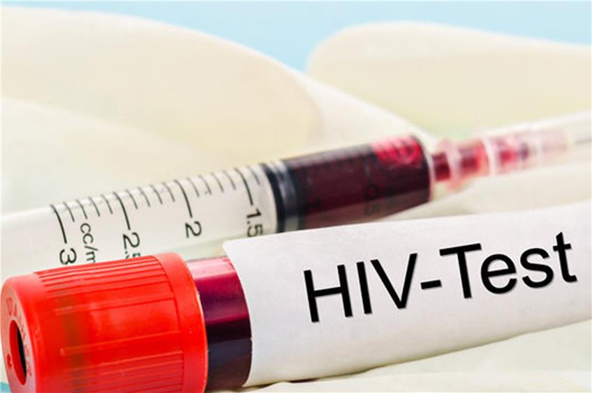 Nach einem riskanten Sexualkontakt kann ein Test für Klarheit über eine mögliche Infektion mit HIV sorgen. Bild: gamjai - Fotolia