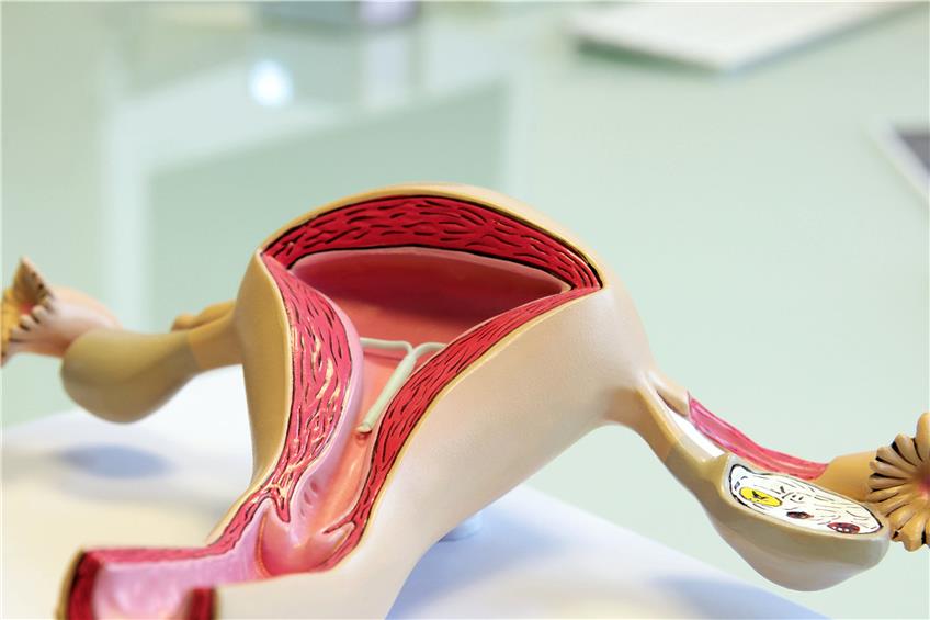 An einer Gebärmutter können die Krankheiten entstehen, zum Beispiel eine Endometriose. Bild: Sven Bähren / fotolia