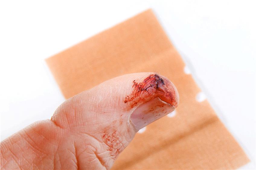 Schon eine kleine Schnittwunde am Finger kann zu einer Blutvergiftung führen. Bild: Jürgen Fälchle / fotolia stock.adobe